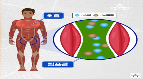 서혜부위치.png