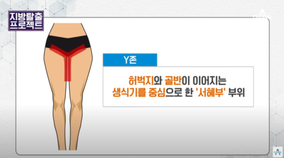 서혜부y존.png